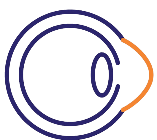 Keratoconus Management